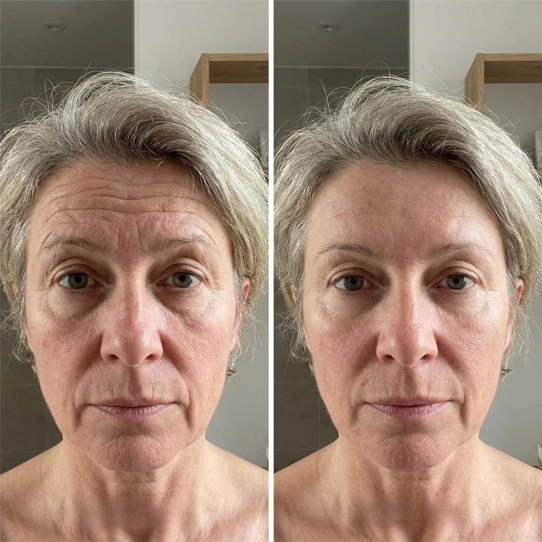 SkinLab™ - Line Smoother Perfect Skin in 3 Minutes