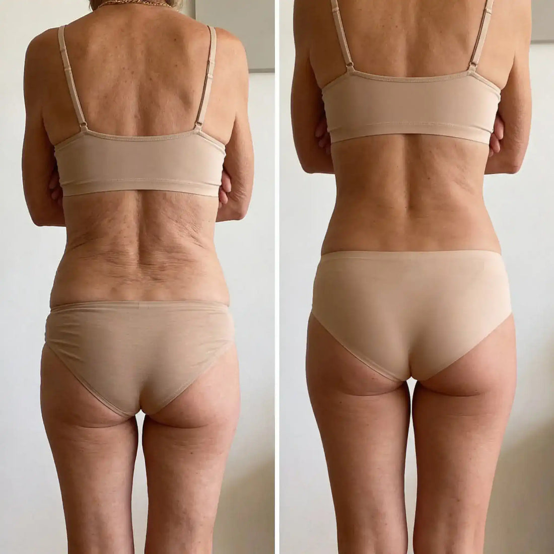 SkinLab Pure™ | Raffermit et affine la peau relâchée de 98 % en 24 heures