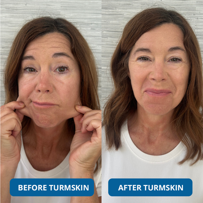 3% Hyaluronic Acid Ultra Hydrating Serum by SkinLab Pure