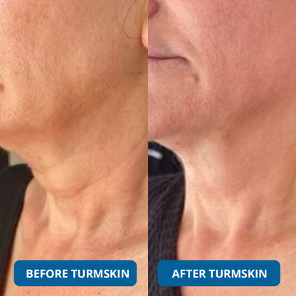3% Hyaluronic Acid Ultra Hydrating Serum by SkinLab Pure