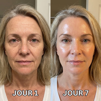 SkinLab Pure™ | Raffermit et affine la peau relâchée de 98 % en 24 heures