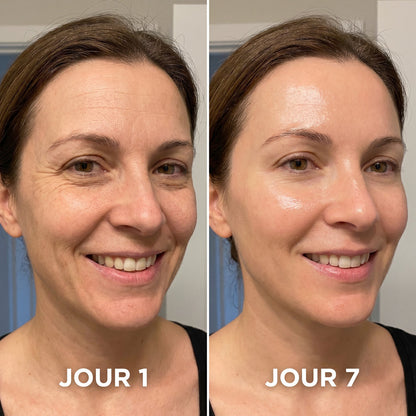 SkinLab Pure™ | Raffermit et affine la peau relâchée de 98 % en 24 heures