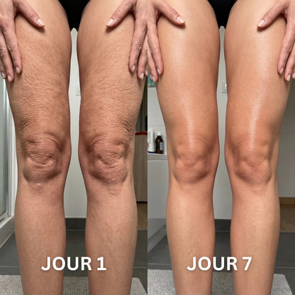 SkinLab Pure™ | Raffermit et affine la peau relâchée de 98 % en 24 heures